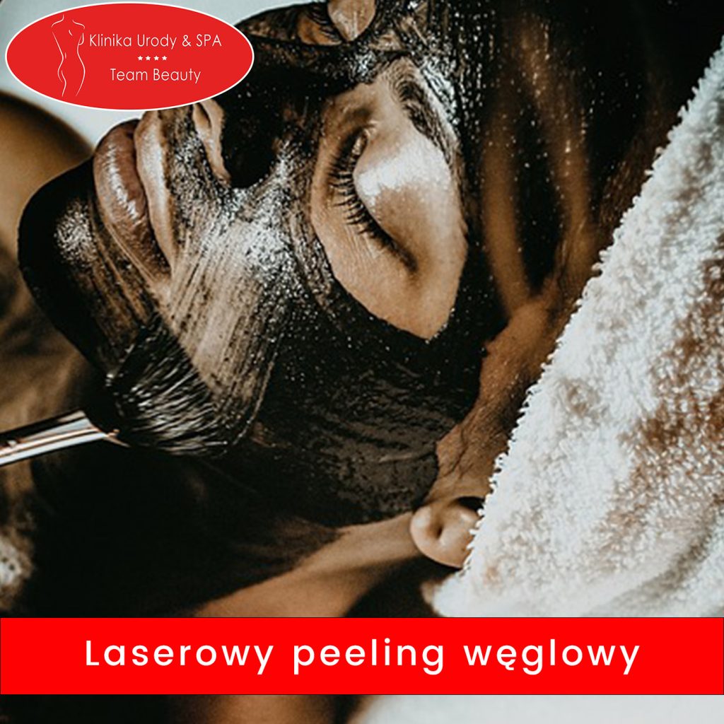 Laserowy peeling węglowy warszawa