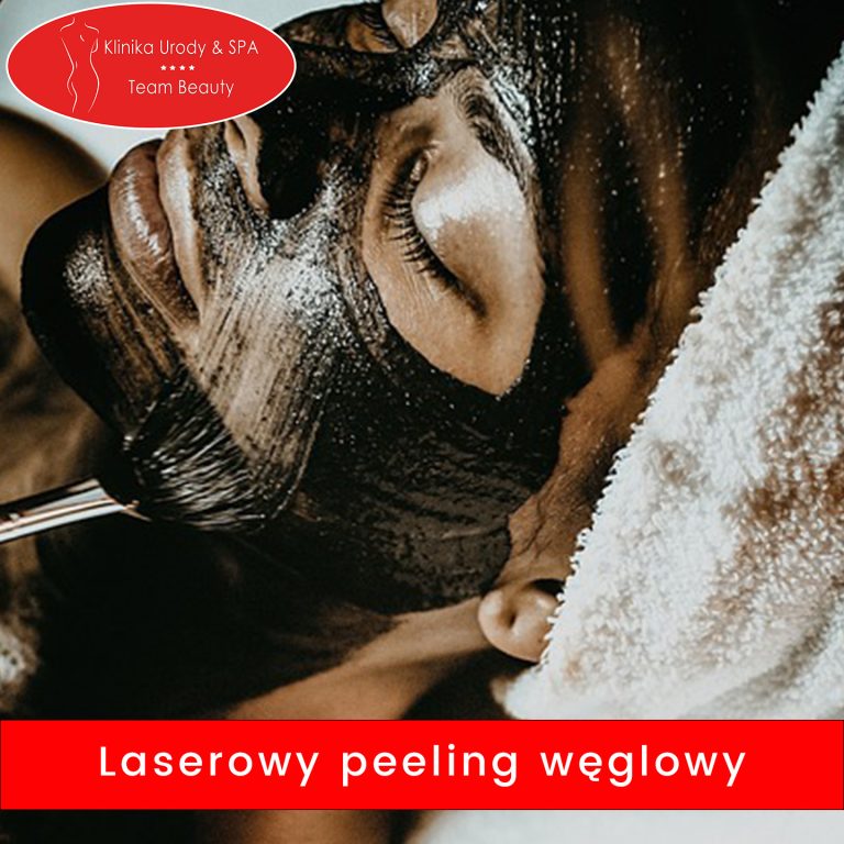 Laserowy peeling węglowy warszawa