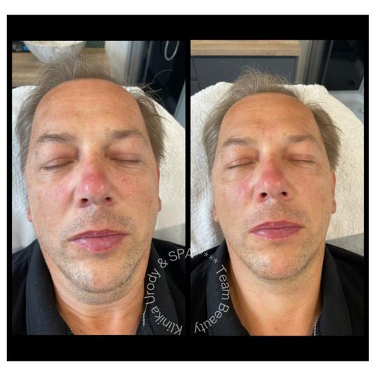 stymulatory tkankowe