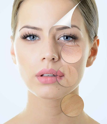 Problem kosmetyczny - zabiegi na Twój problem